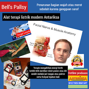 BELL'S PALSY