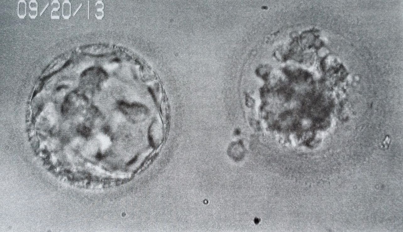 Unexpected Grace 7 month after this all started finally its