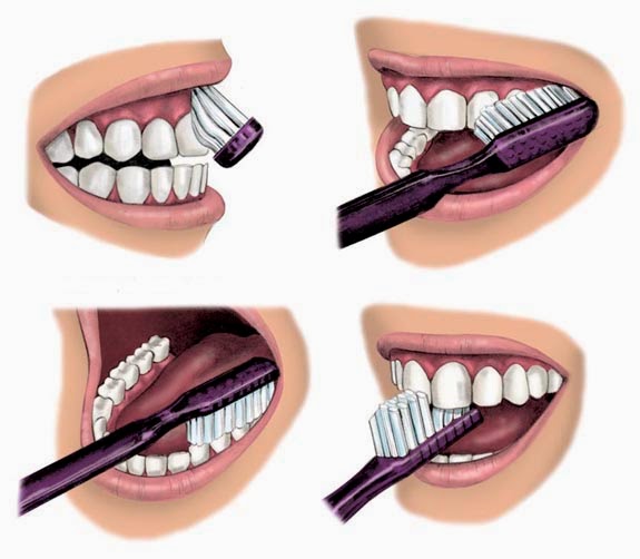 Comment se brosser les dents après canal radiculaire