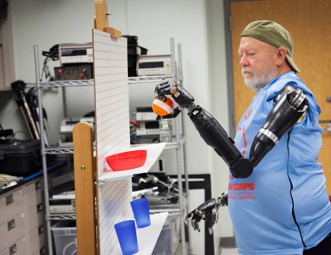 This Man Lived Without Arms For 40 Years, And Now He Has New Ones This Man Lived Without Arms For 40 Years, And Now He Has New Ones