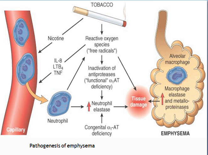 the pathophysiology of a disease copd In patients with chronic obstructive pulmonary disease (copd), pro-inflammatory and pro-destructive pathways are activated, at times independent of smoke exposure, and other anti-inflammatory, anti-oxidant, or repair pathways are down-regulated, all resulting in lung destruction. the pathophysiology of a disease copd In patients with chronic obstructive pulmonary disease (copd), pro-inflammatory and pro-destructive pathways are activated, at times independent of smoke exposure, and other anti-inflammatory, anti-oxidant, or repair pathways are down-regulated, all resulting in lung destruction.