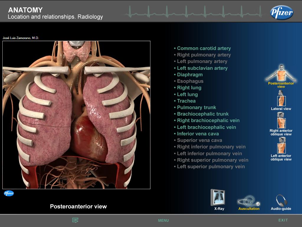 Melihat Jantung Pada Proyeksi Rontgen (Bagian I)