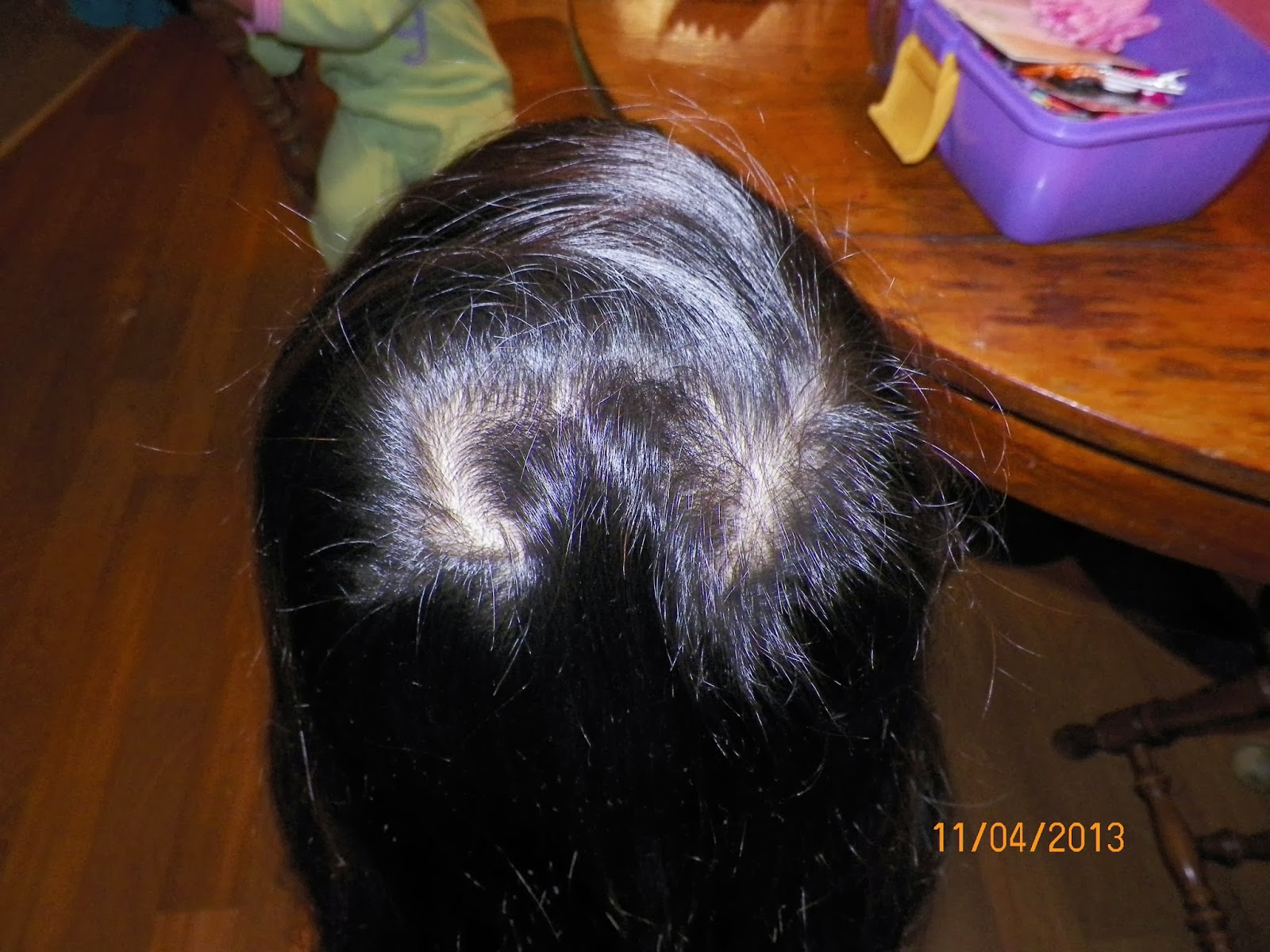 mygreatfinds: Both my daughters have double cowlicks\/hair whorls!