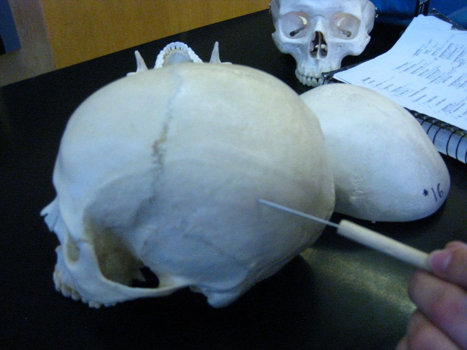 Boned: Human Skull - parietal bones (calvarial bones # 2 and # 3)