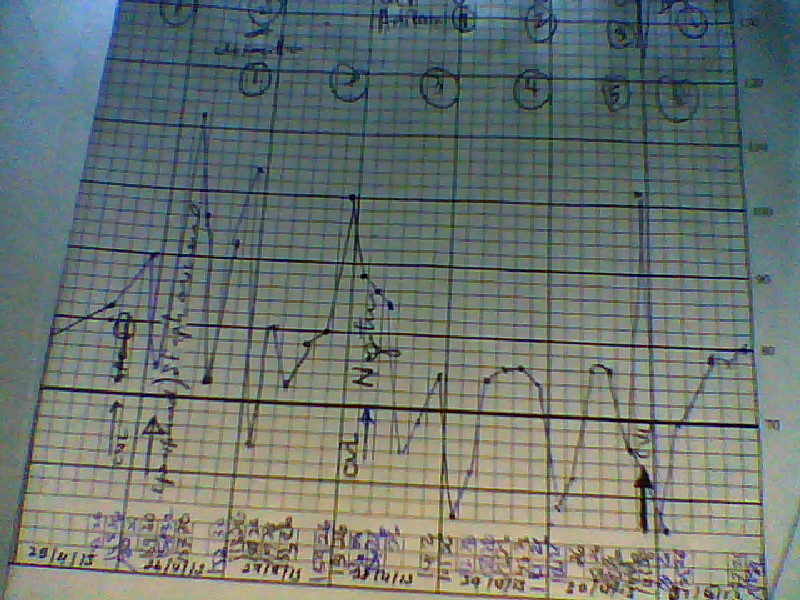 Hospital Temperature Chart