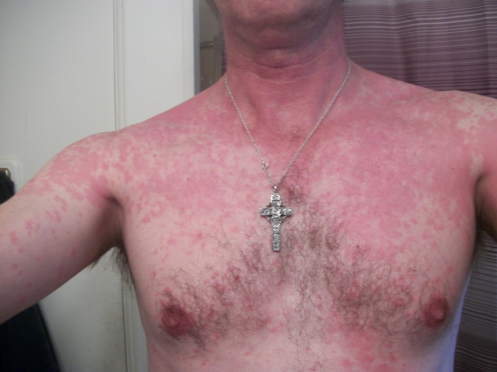 Joe Exercise, Niacin and Sauna