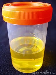 o que é e qual a composição da urina