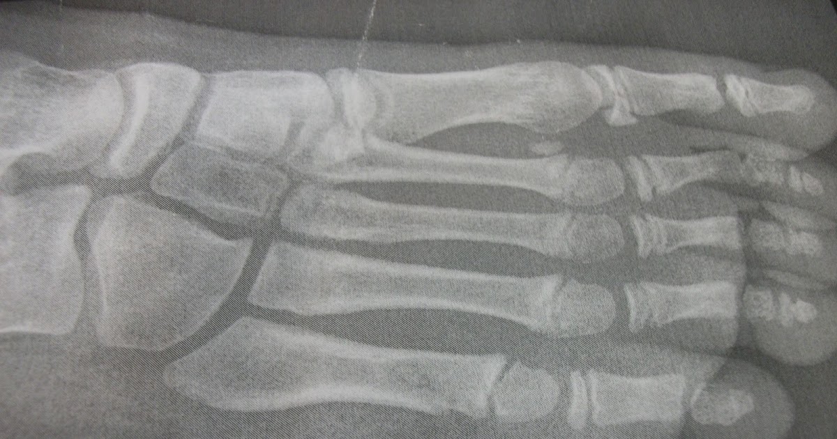 Room 12 Beside The Sea X Rays