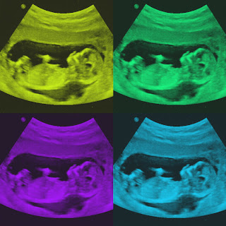 ultrasound party scan