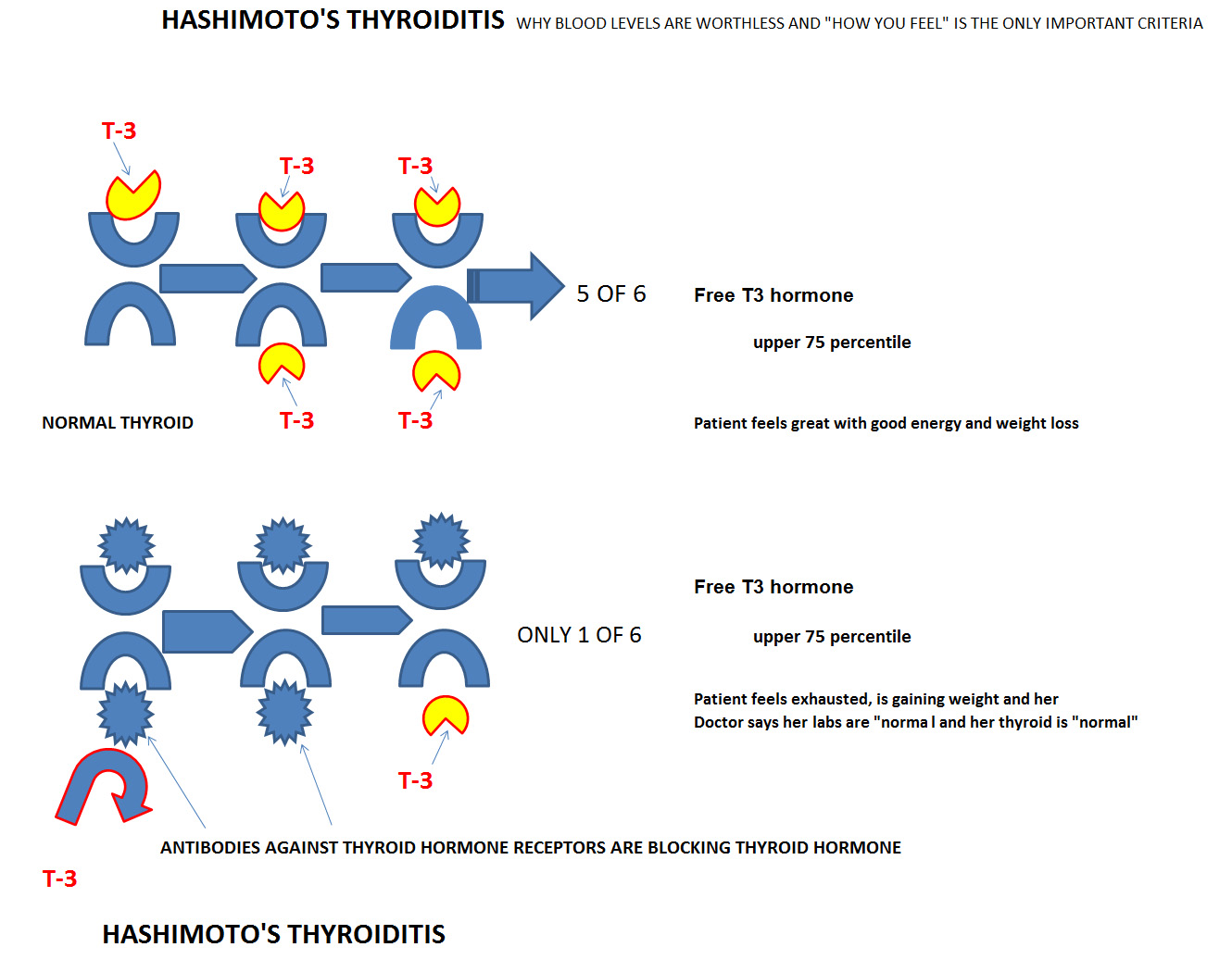 The Menopausal Cocktail is not your friend. Hashimoto's Thyroiditis