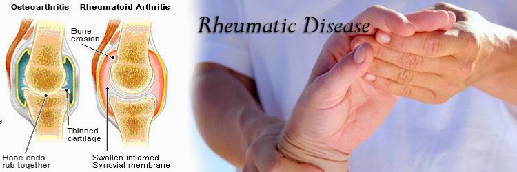 Rheumatic Disease, rematik, sendi, ligamen, tendon, saraf, osteoartritis, rhematoid arthritis, pirai, poliartritis
