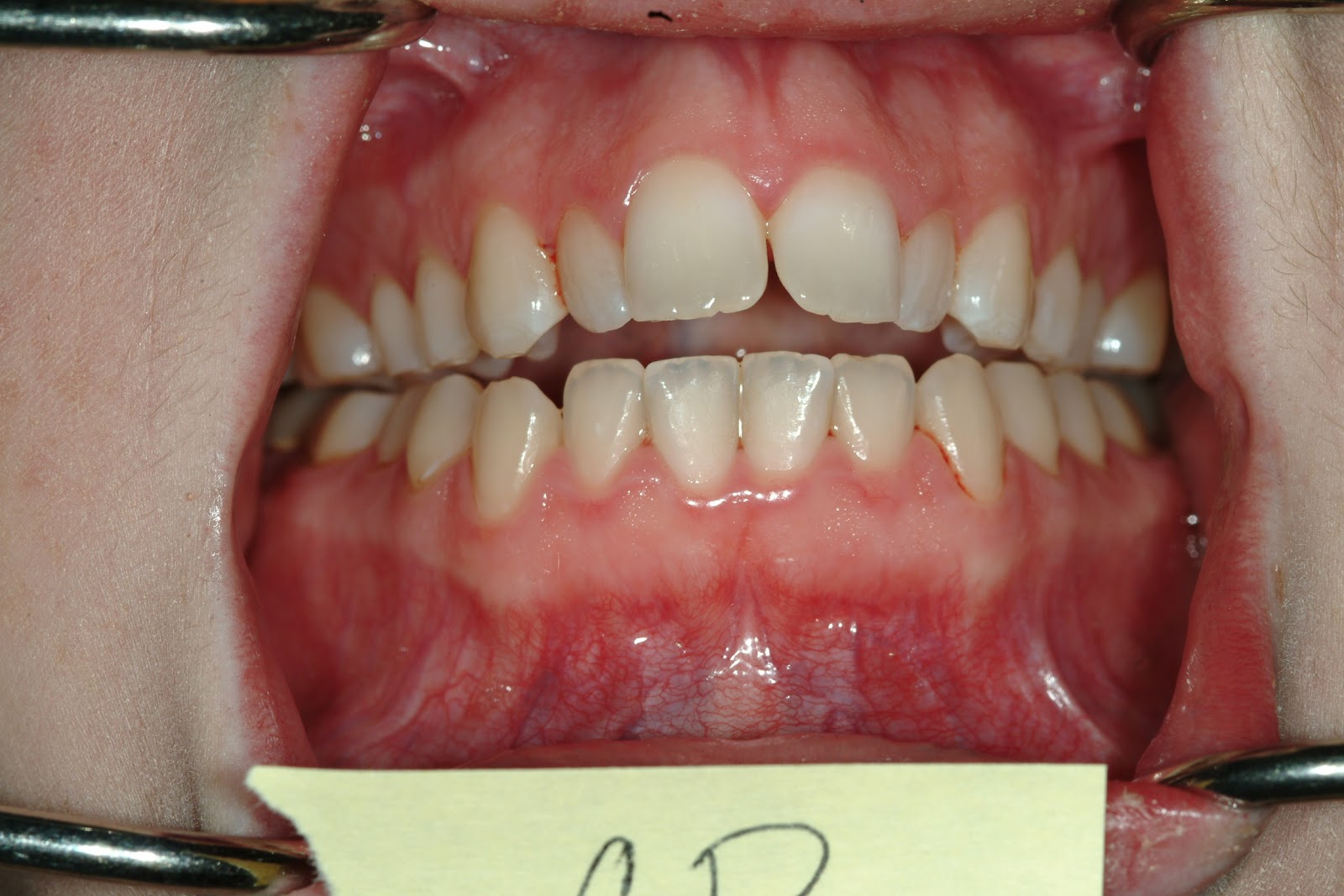 Retain This! DNA Appliance Day 1 14