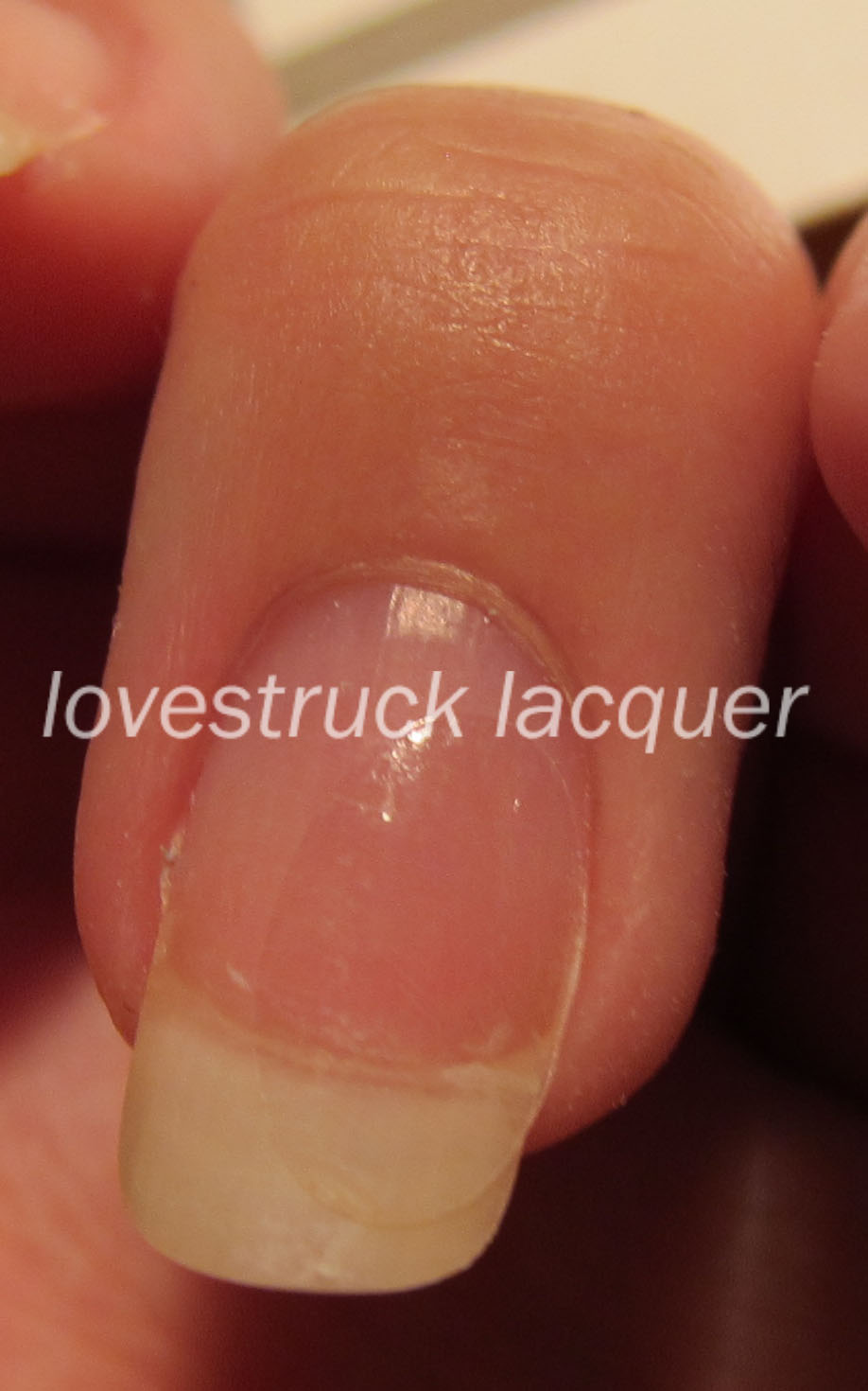 Lovestruck Lacquer Supernail Nail Bandage review