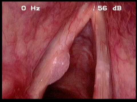 Rid of guys get hpv do HPV infection
