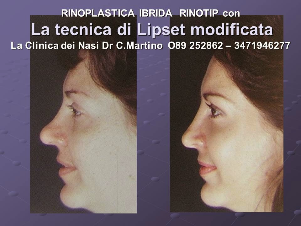 La Clinica Dei Nasi Dr Martino Salerno Febbraio 15