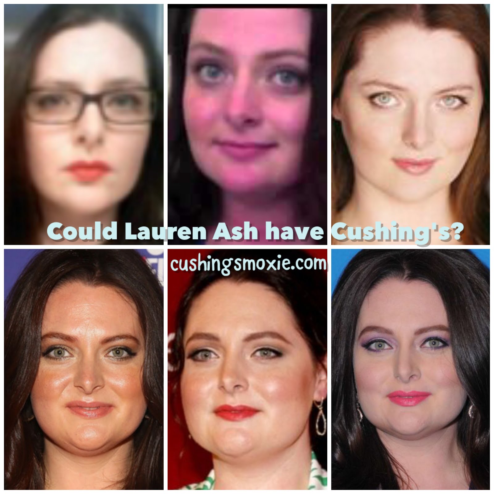 Cushing's with Moxie Fighting The Worst Disease You've Never Heard Of