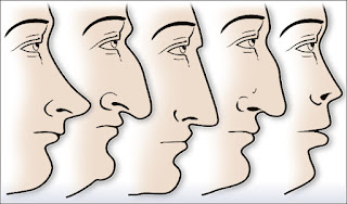 Nose-health-1.jpg