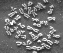 cariotipo humano formado por 23 parejas de cromosomas