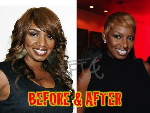 NeNe Leakes Plastic Surgery Before and After Nose Jobs and Breast