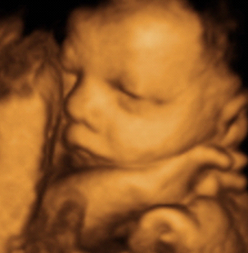 30 weeks pregnant 3d ultrasound