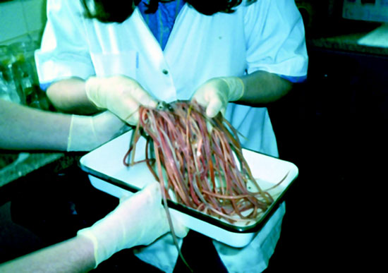 Que medicina trata lyambliya