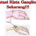 Cara Mengobati Kista Ganglion Secara Alami