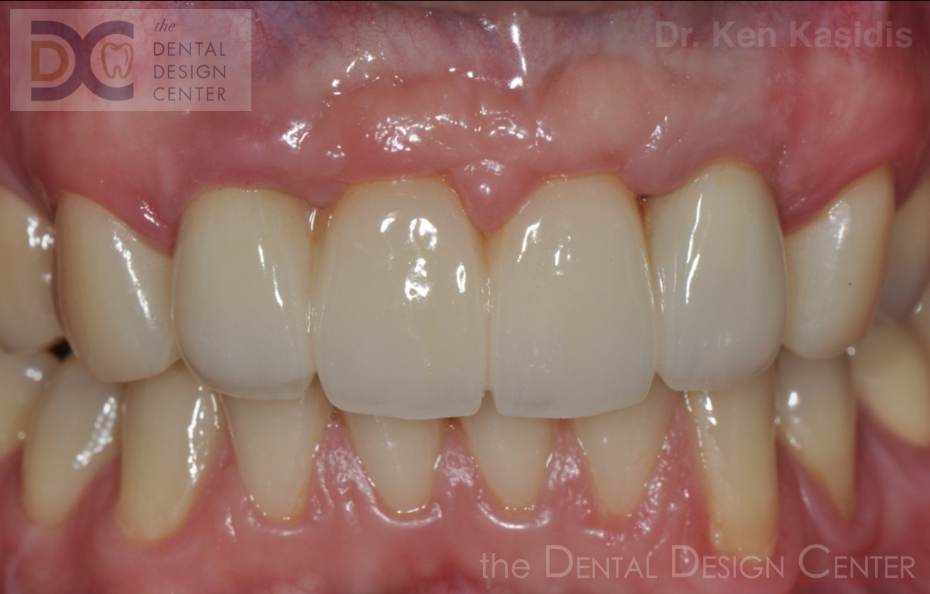 Dental%2Bimplant%2Bdental%2Bclinic%2Bpattaya