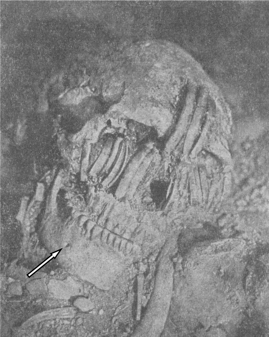 Gigantic Human Skeleton