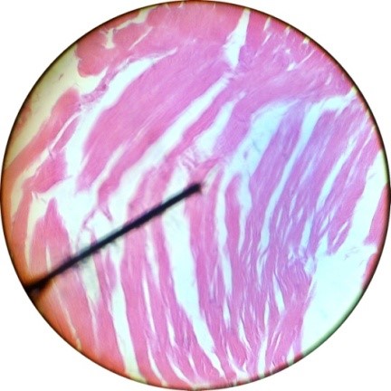 Jika dilihat dengan mikroskop sel otot lurik berbentuk