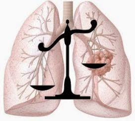 Mesothelioma: Legal Ramifications