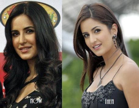 Chatter Busy: Katrina Kaif Plastic Surgery