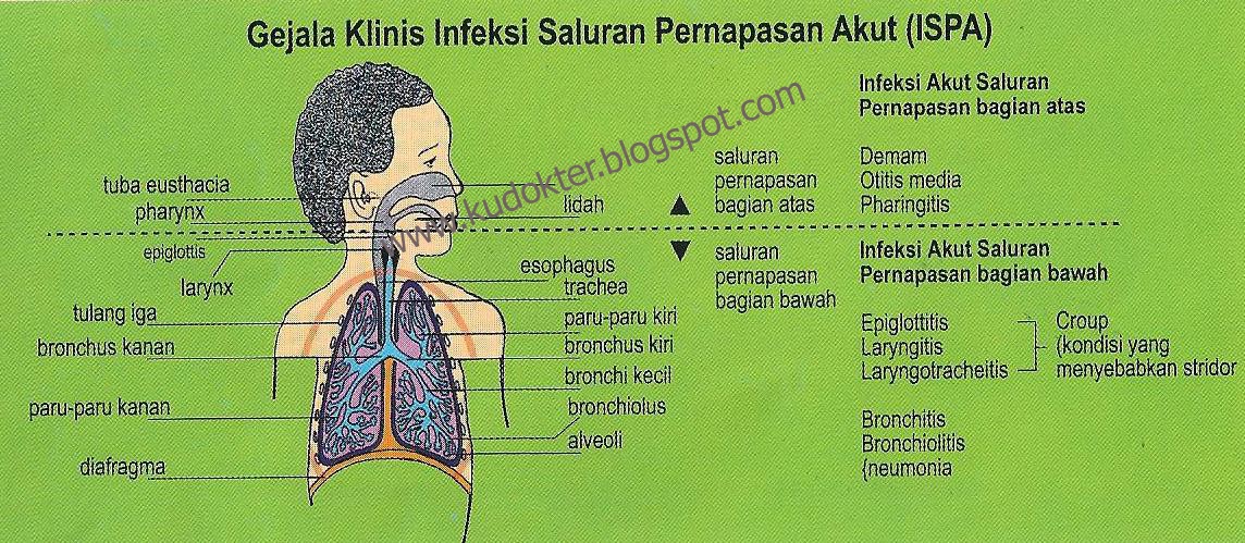 Obat Herbal Penyakit Ispa - Kudokter Herbal Terpercaya