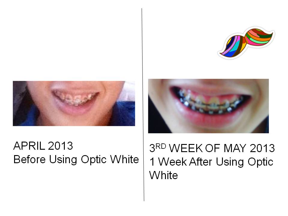 Mr Pogi Tips Colgate Optic White Toothpaste Review