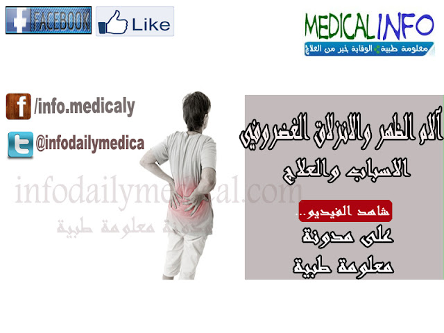آلام الظهر والانزلاق الغضروفي..الاسباب والعلاج