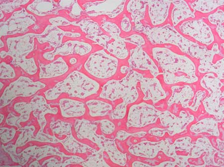 Salisbury's Graduate Histology: Bone and practice practicals