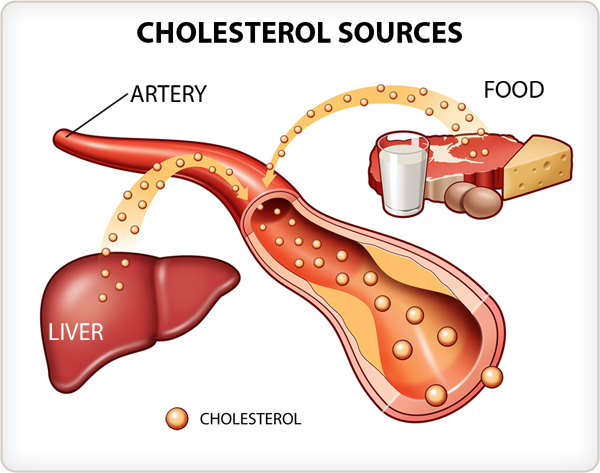 high Cholesterol source