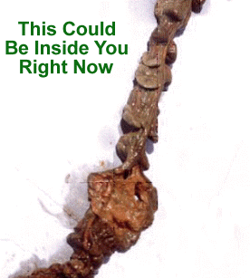 mucoid colon plaque cleanse fasting detox bowel movements gut nutrients blife active works intestines parasites