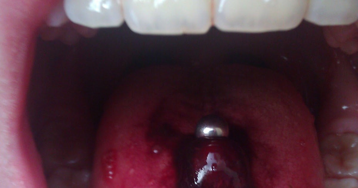 Things I Couldn't Google Tongue piercing week 1 2