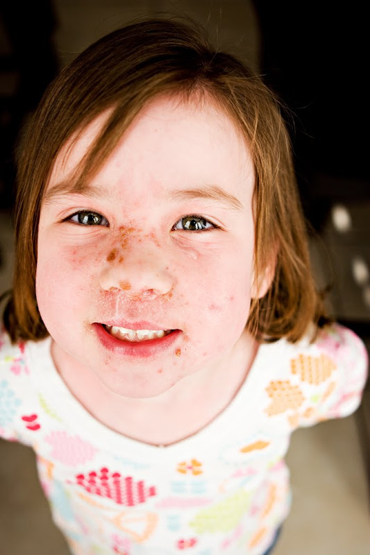 Happenings at Home Strep Face