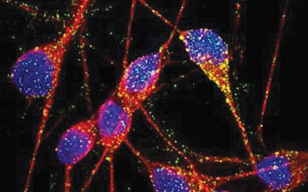 Lip Cells