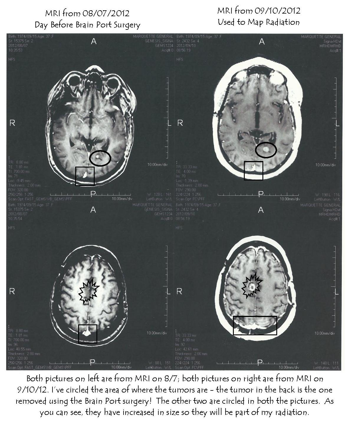 An Amazing Brain... Feeling Good with This Crazy Brain And a