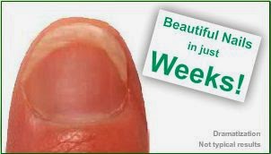 How to Cure dark toenails: How to cure dark toenails