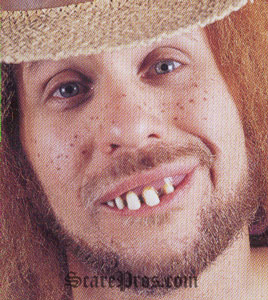 funny wisdom teeth quotes - ONLINE NEWS ICON