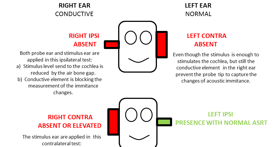 UNDERSTANDING THE PRINCIPLES OF PROBE EAR AND STIMULUS EAR (ACOUSTIC