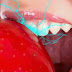  الأسنان الحساسة - كيف نهدئ الألم؟