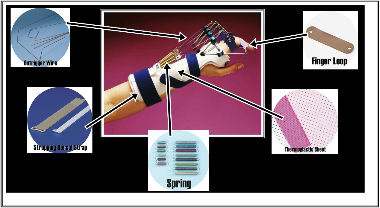 OCCUPATIONAL THERAPY The Prologue of Splinting