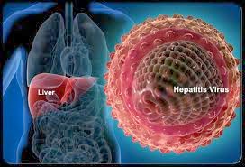 Obat Alami Penyembuh Penyakit Hepatitis B