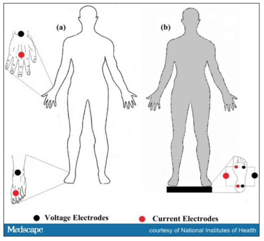 安慎診所 血液透析 透析週報 末期腎臟病患者體液過多 水分過多 及死亡風險 Bioimpedance Spectroscopy Bis 生物阻抗分析儀