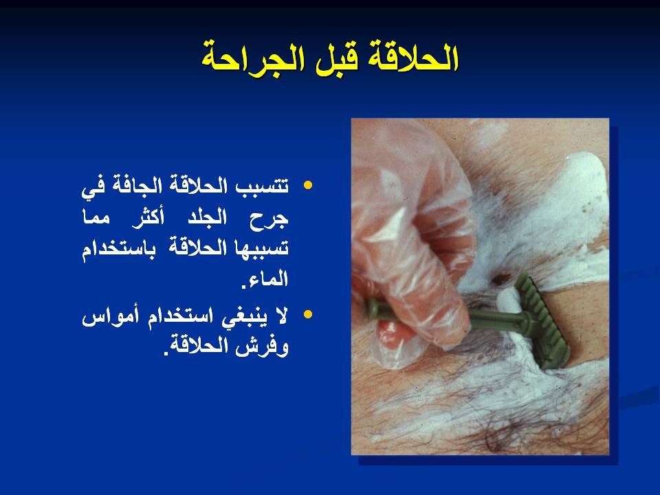 مكافحة عدوى وتلوث المستشفيات غرف العمليات ومكافحة العدوى