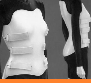brace jacket compression jewett spinal fractures before clamshell orthosis thoracic orthotics flexion surgery extension prosthetics sassy lateral shower broken treatment